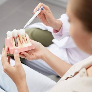 Dental Implants in Guelph